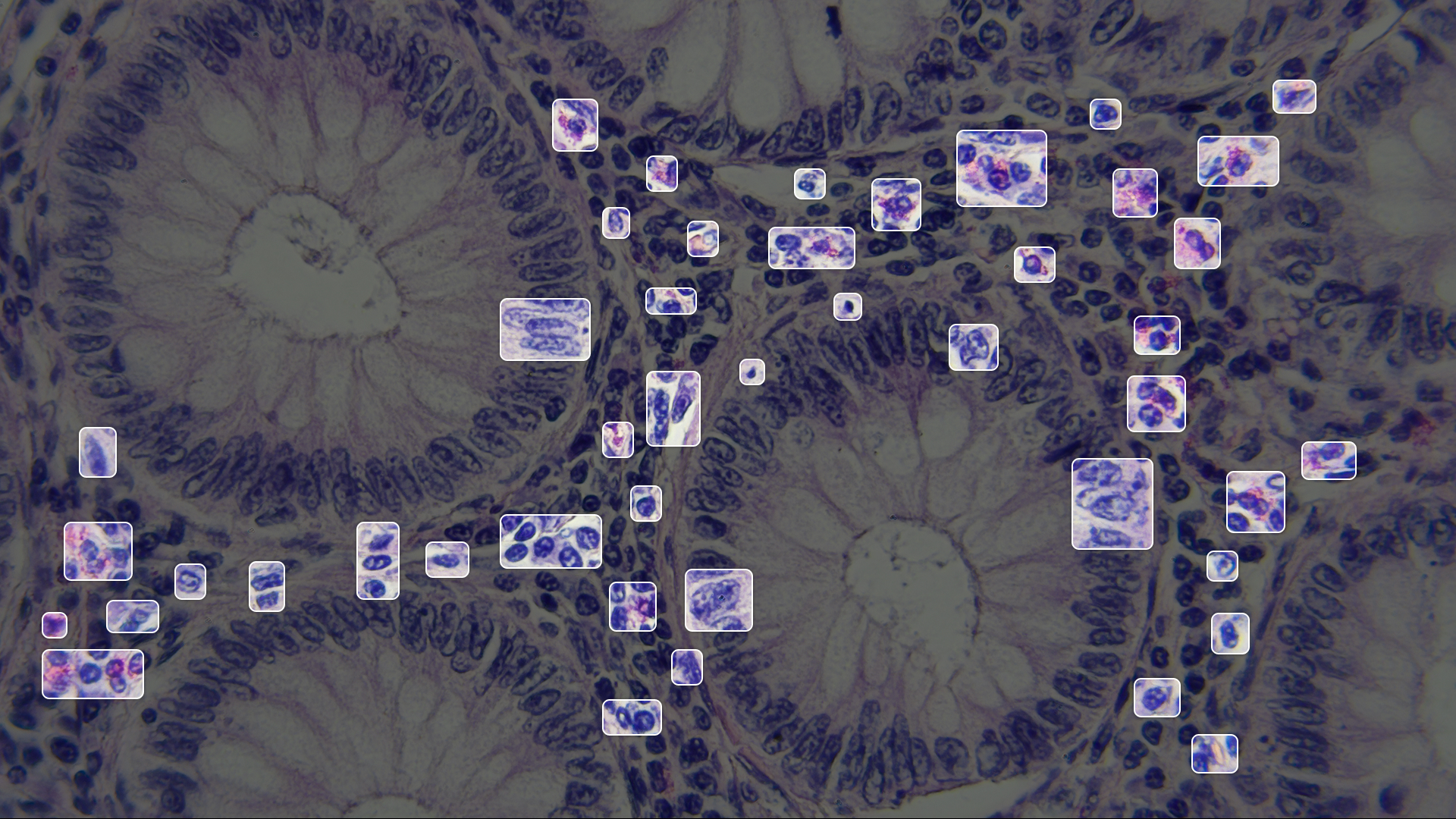 Building foundation models for understanding human pathology using DINOv2